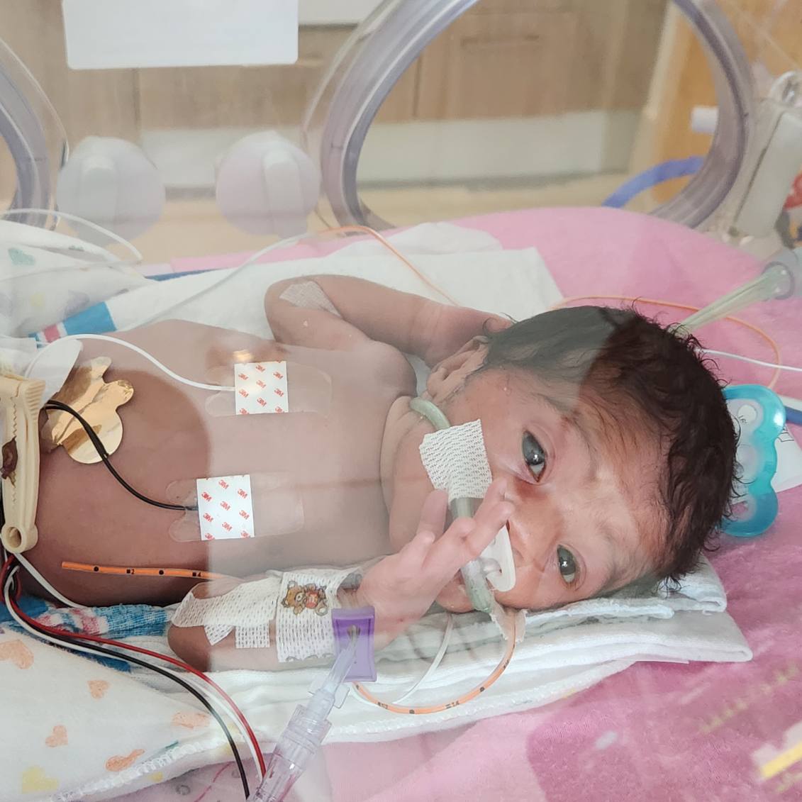 Family holding Harper’s tiny hand
