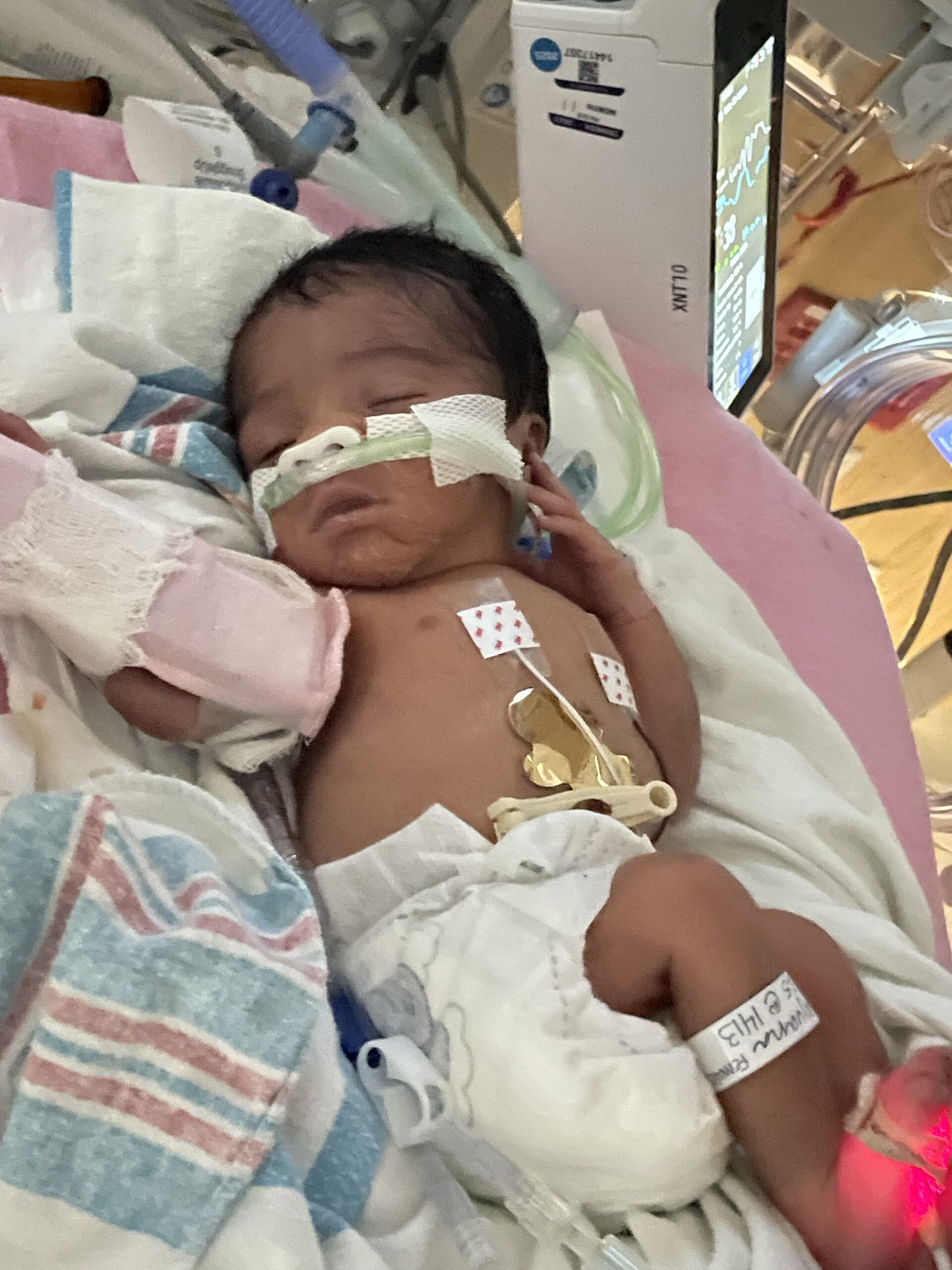 Harper smiling in NICU