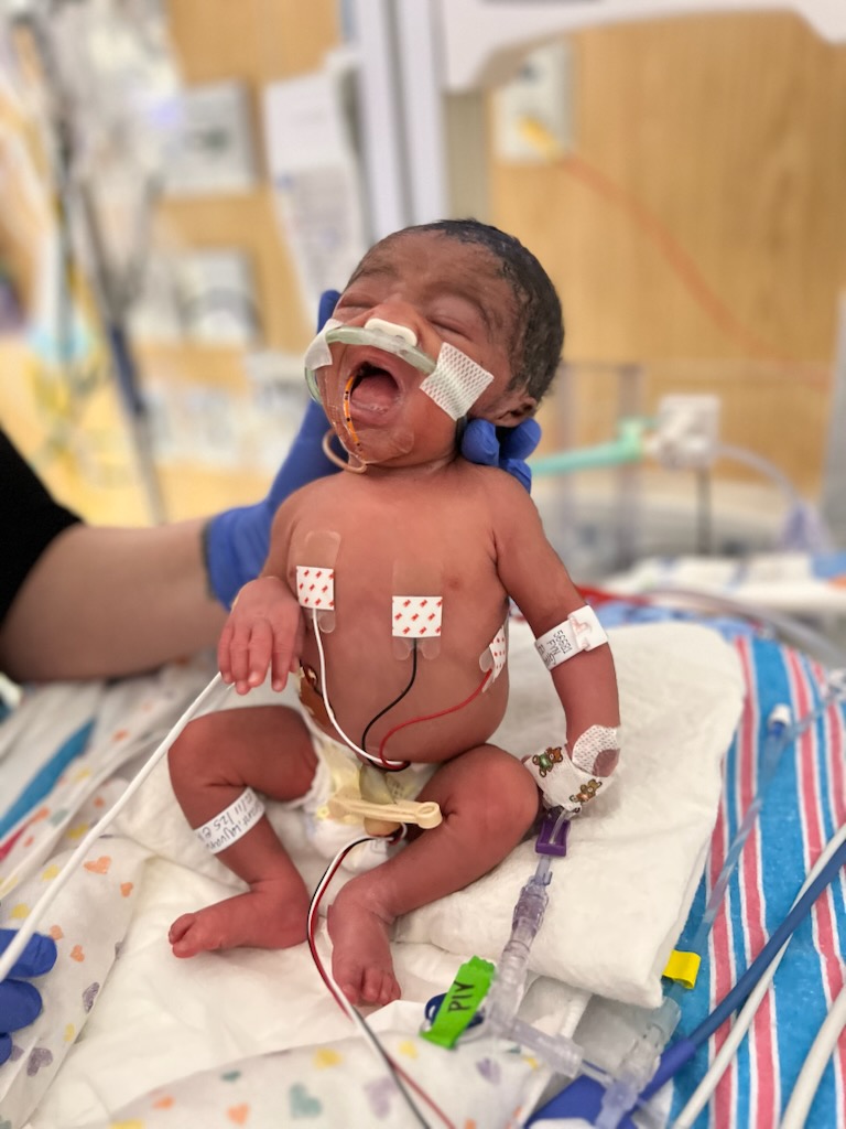 Parents comforting their infant, representing support through NEC challenges